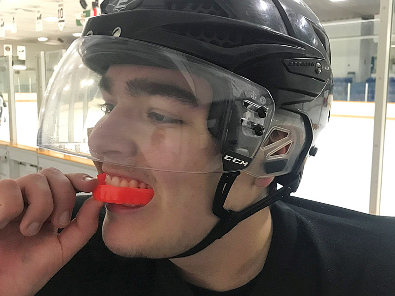 Custom Mouthguards